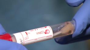 Covid-19 patient numbers in hospital and ICU fall for first time in two weeks