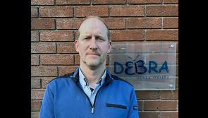 Gel therapy to treat &lsquo;butterfly skin&rsquo; condition welcomed by Irish charity