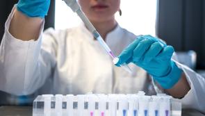 'Always better to be prepared' - Irish Monkeypox team formed