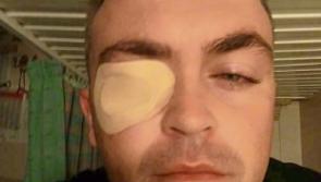Limerick fire breather admitted to A&E in Bahamas after burning eyes with chilli crisp fingers