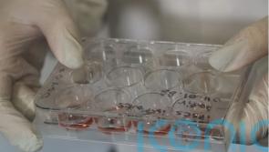 Paralysed people could walk again thanks to newly created 3D spinal cord implants