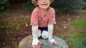 Book about &lsquo;warrior&rsquo; four-year-old helps classmates understand skin condition