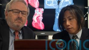 New approach to diagnosing heart disease hailed as potential &lsquo;game changer&rsquo;