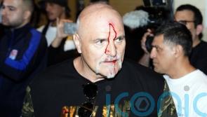Tyson Fury&rsquo;s father John suffers cut to head as Oleksandr Usyk fight week begins