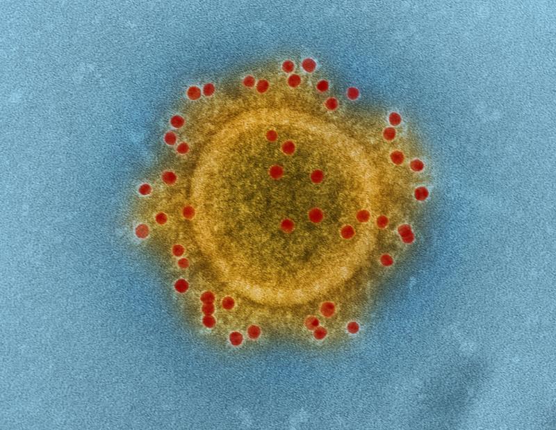 EXPLAINER: Everything you need to know about the new Omicron XE subvariant