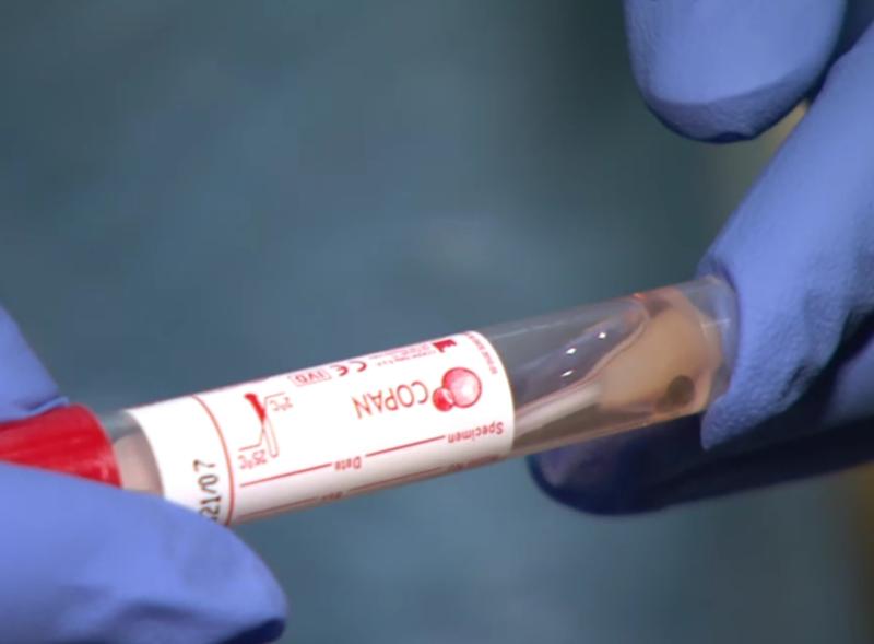 Almost 40,000 positive cases of Covid-19 recorded in Ireland in one week - HPSC