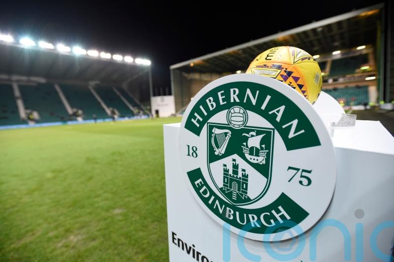 Hibs owner Ron Gordon says &lsquo;it won&rsquo;t happen again&rsquo; after error leads to cup exit