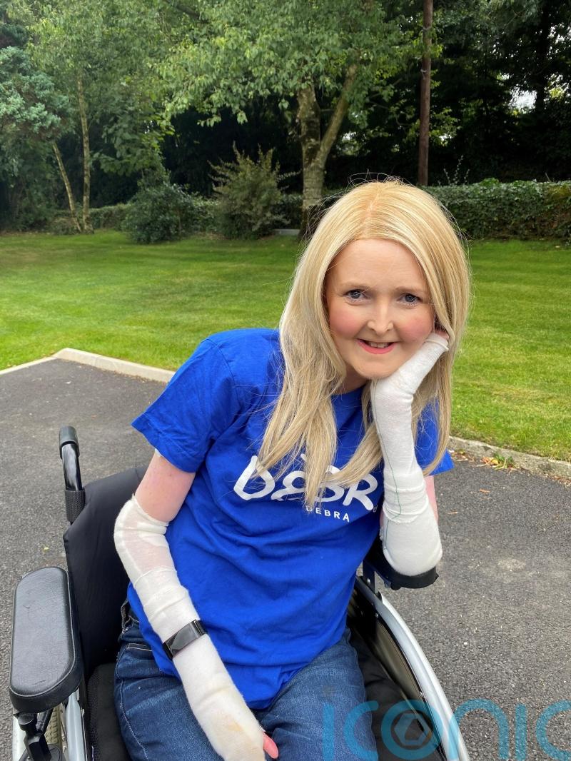 Wheelchair-user with debilitating skin condition set for charity challenge