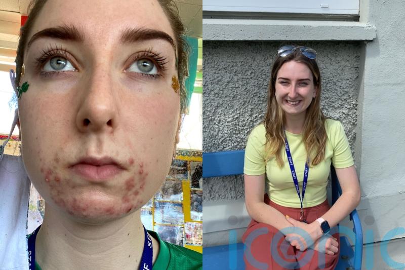 Irish teacher whose acne beard scared her pupils finds solution using AI technology