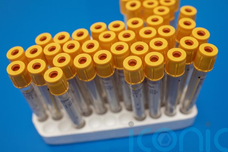 Adult diagnosed with measles dies in Irish hospital