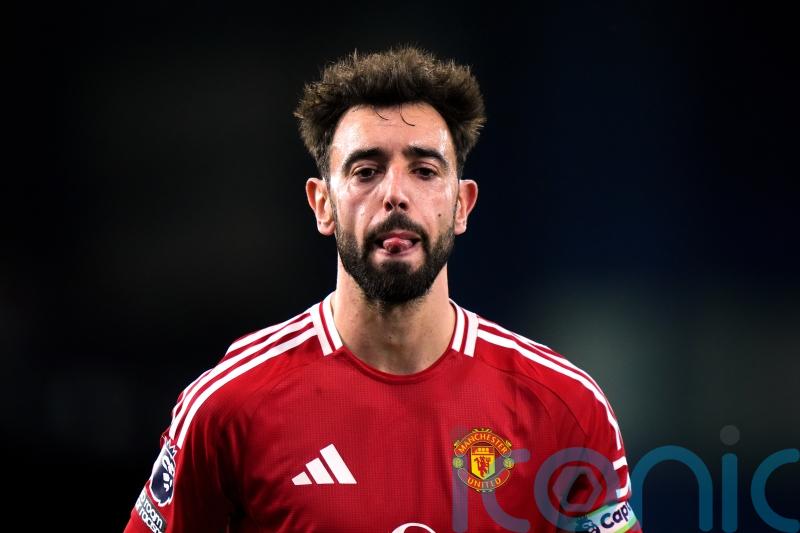 Bruno Fernandes urges United to forget City&rsquo;s problems and focus on own issues