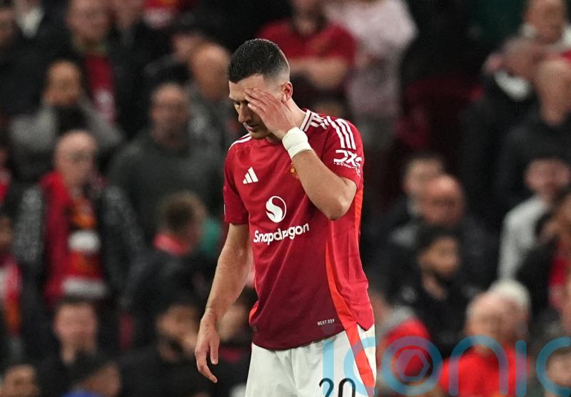 Manchester United&rsquo;s Diogo Dalot could miss rest of season with calf injury